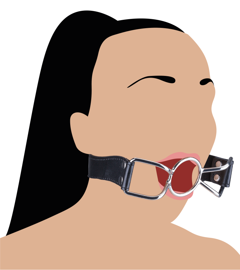 Spider mouth gag